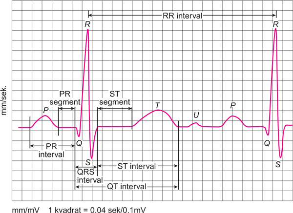 ekg zapis